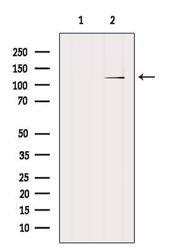 ITGA3 Antibody in Western Blot (WB)