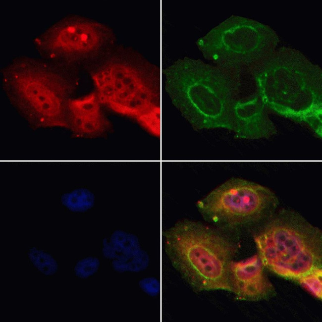 RUNX3 Antibody in Immunocytochemistry (ICC/IF)