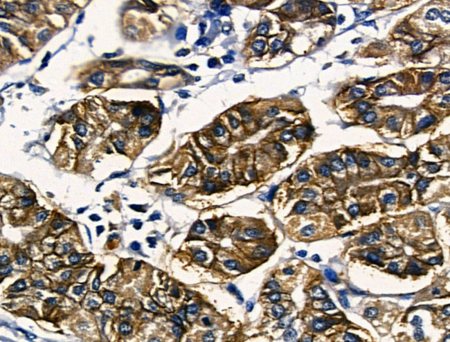 RUNX3 Antibody in Immunohistochemistry (Paraffin) (IHC (P))