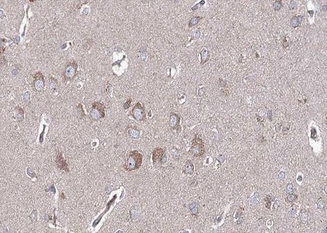 BMP-6 Antibody in Immunohistochemistry (Paraffin) (IHC (P))