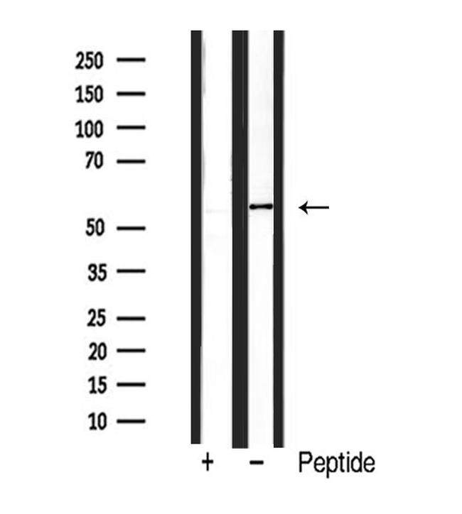 BMP-6 Antibody in Western Blot (WB)