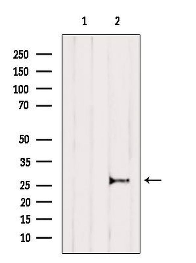 IL-11 Antibody in Western Blot (WB)