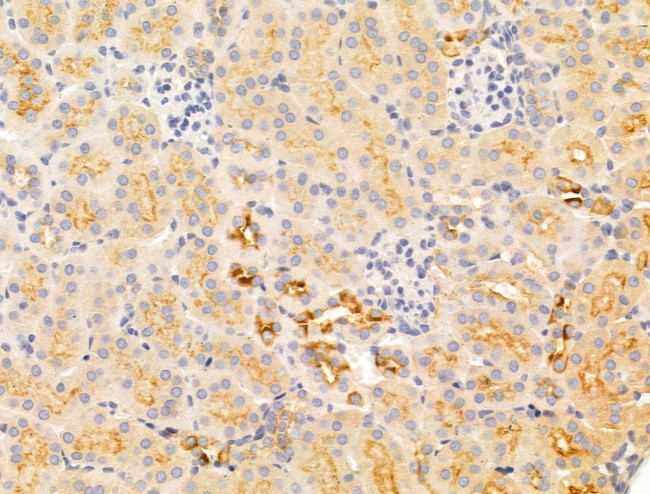 IL-11 Antibody in Immunohistochemistry (Paraffin) (IHC (P))