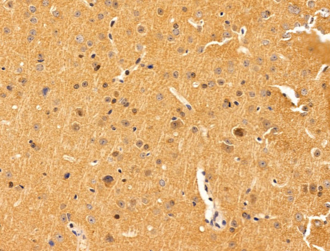 IL-11 Antibody in Immunohistochemistry (Paraffin) (IHC (P))