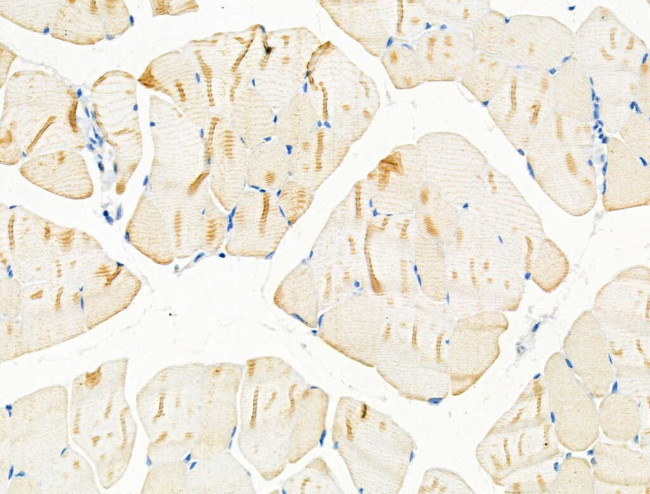 alpha Actinin 2/3 Antibody in Immunohistochemistry (Paraffin) (IHC (P))