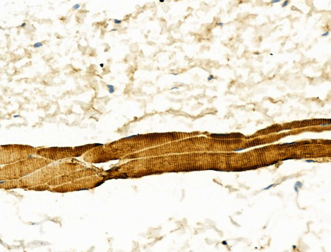 alpha Actinin 2/3 Antibody in Immunohistochemistry (Paraffin) (IHC (P))