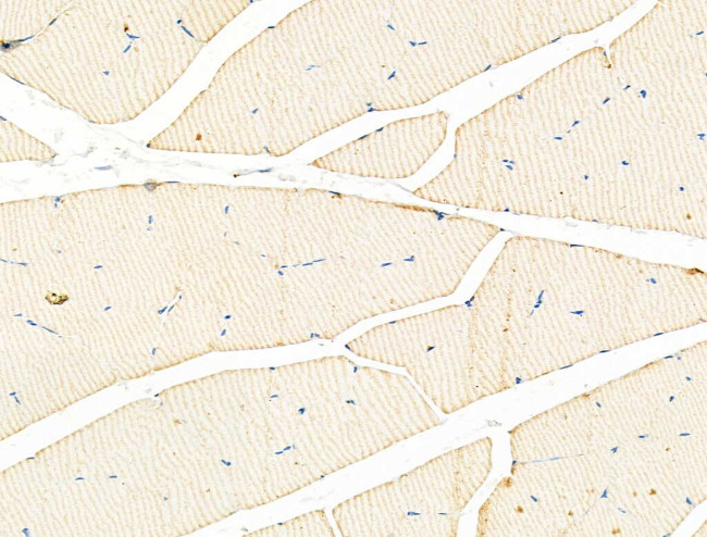 alpha Actinin 2/3 Antibody in Immunohistochemistry (Paraffin) (IHC (P))