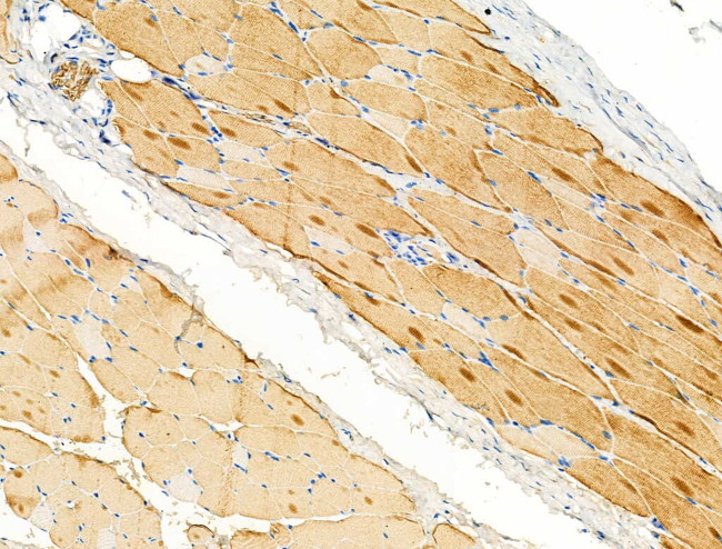 alpha Actinin 2/3 Antibody in Immunohistochemistry (Paraffin) (IHC (P))