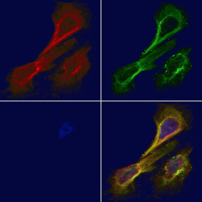 alpha Actinin 2/3 Antibody in Immunocytochemistry (ICC/IF)