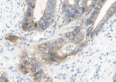 alpha Actinin 2/3 Antibody in Immunohistochemistry (Paraffin) (IHC (P))