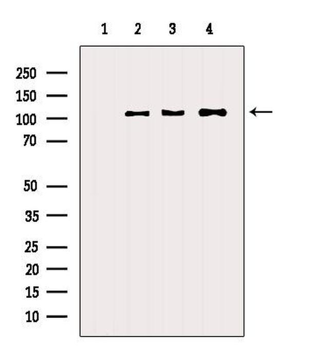 alpha Actinin 2/3 Antibody in Western Blot (WB)