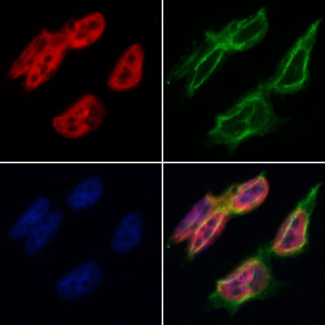 Bub3 Antibody in Immunocytochemistry (ICC/IF)