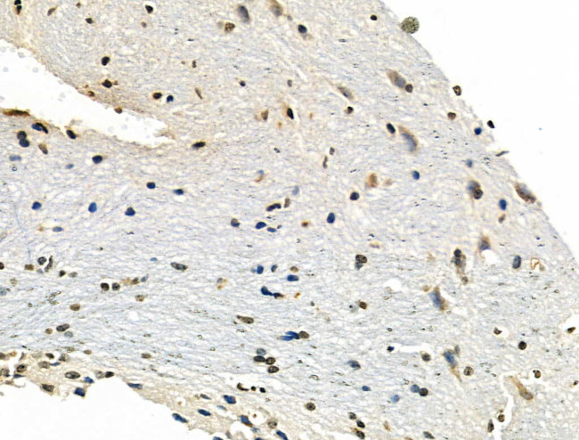 NOTCH2 (Cleaved Ala1734) Antibody in Immunohistochemistry (Paraffin) (IHC (P))