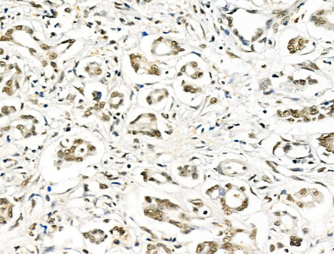 hnRNP C1/C2 Antibody in Immunohistochemistry (Paraffin) (IHC (P))