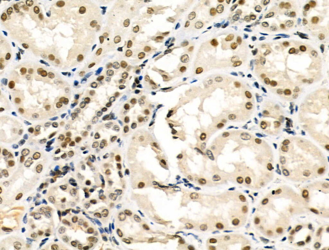 hnRNP C1/C2 Antibody in Immunohistochemistry (Paraffin) (IHC (P))