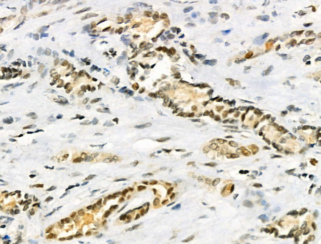 hnRNP C1/C2 Antibody in Immunohistochemistry (Paraffin) (IHC (P))