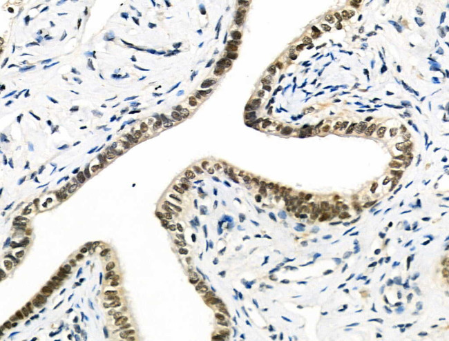 hnRNP C1/C2 Antibody in Immunohistochemistry (Paraffin) (IHC (P))