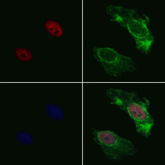 hnRNP C1/C2 Antibody in Immunocytochemistry (ICC/IF)