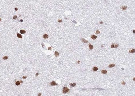 hnRNP C1/C2 Antibody in Immunohistochemistry (Paraffin) (IHC (P))