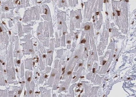 KEAP1 Antibody in Immunohistochemistry (Paraffin) (IHC (P))