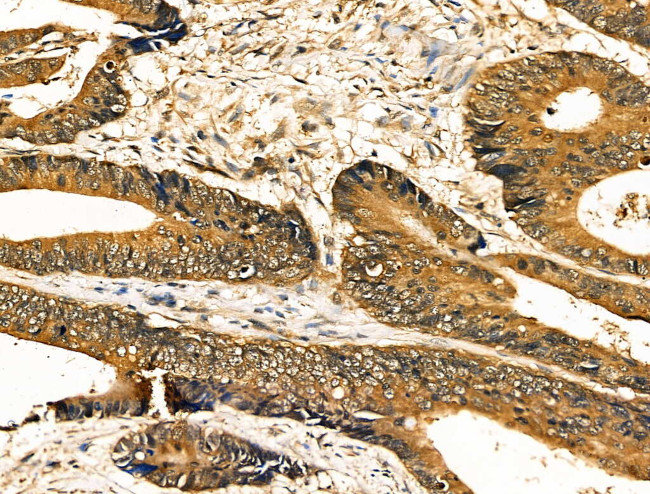 Caspase 8 (Cleaved Asp384) Antibody in Immunohistochemistry (Paraffin) (IHC (P))