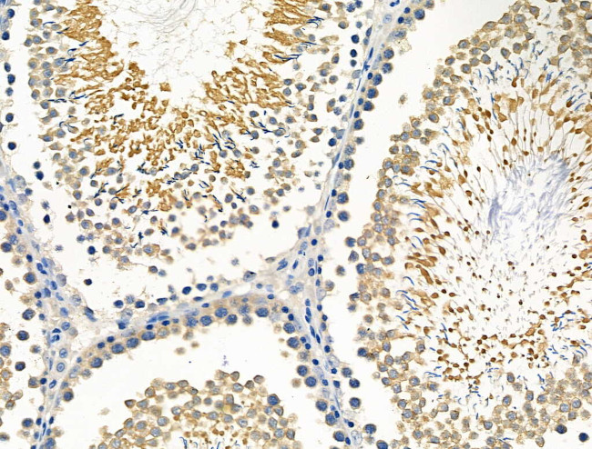 Caspase 8 (Cleaved Asp384) Antibody in Immunohistochemistry (Paraffin) (IHC (P))