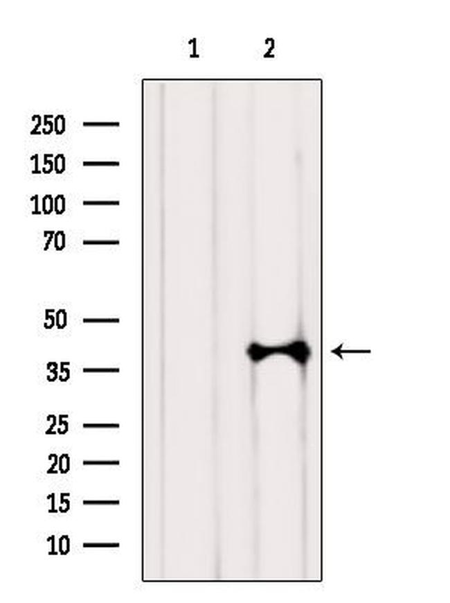 hnRNP A1 Antibody in Western Blot (WB)