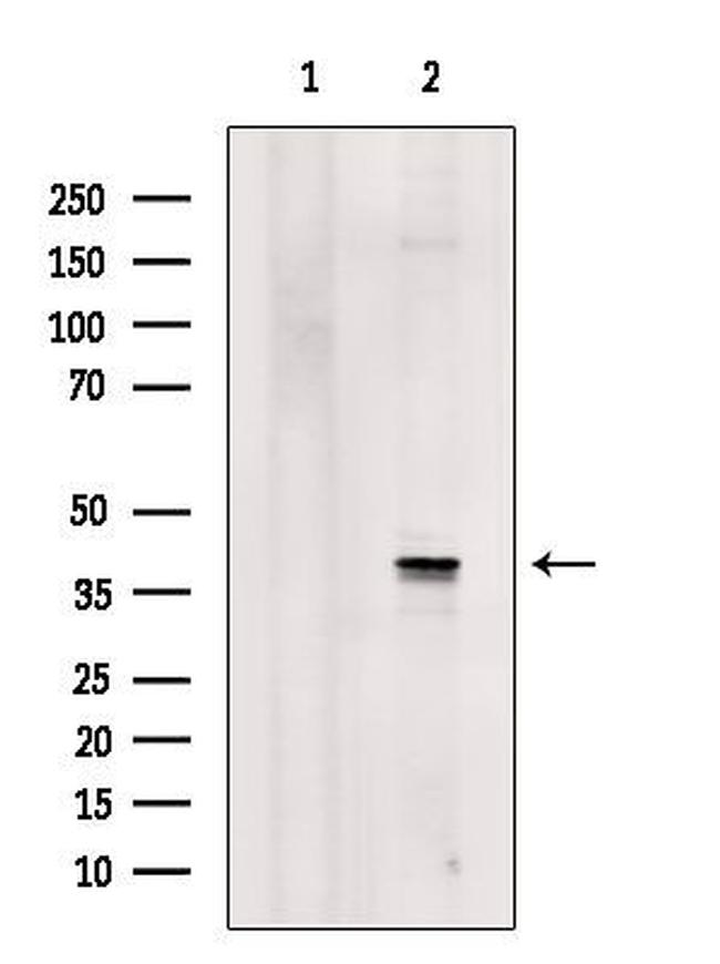 hnRNP A1 Antibody in Western Blot (WB)