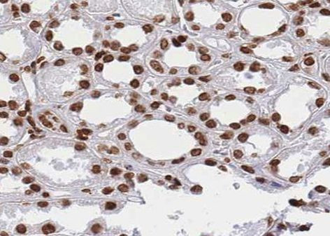 hnRNP M1-M4 Antibody in Immunohistochemistry (Paraffin) (IHC (P))