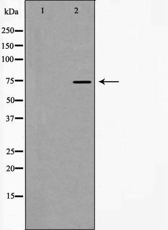 hnRNP M1-M4 Antibody in Western Blot (WB)