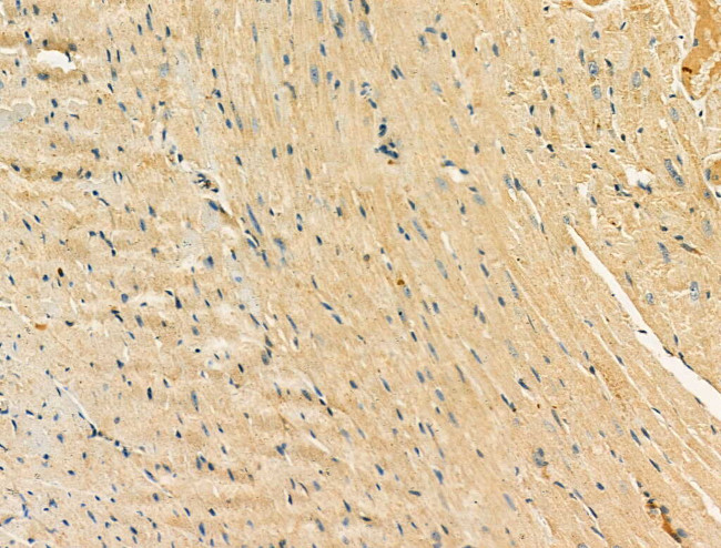 Kir6.2 (KCNJ11) Antibody in Immunohistochemistry (Paraffin) (IHC (P))