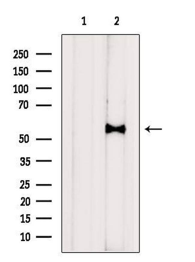 Kir6.2 (KCNJ11) Antibody in Western Blot (WB)