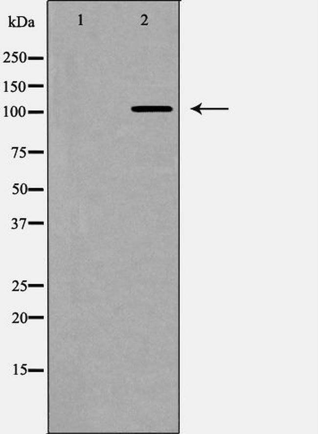 NOTCH2 (Cleaved Asp1733) Antibody in Western Blot (WB)