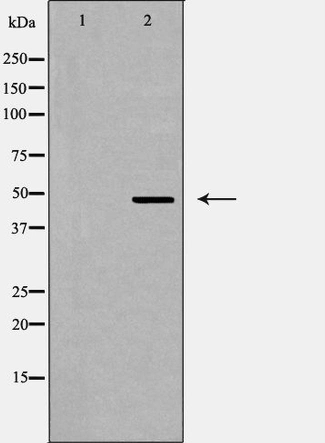 QRFPR Antibody in Western Blot (WB)