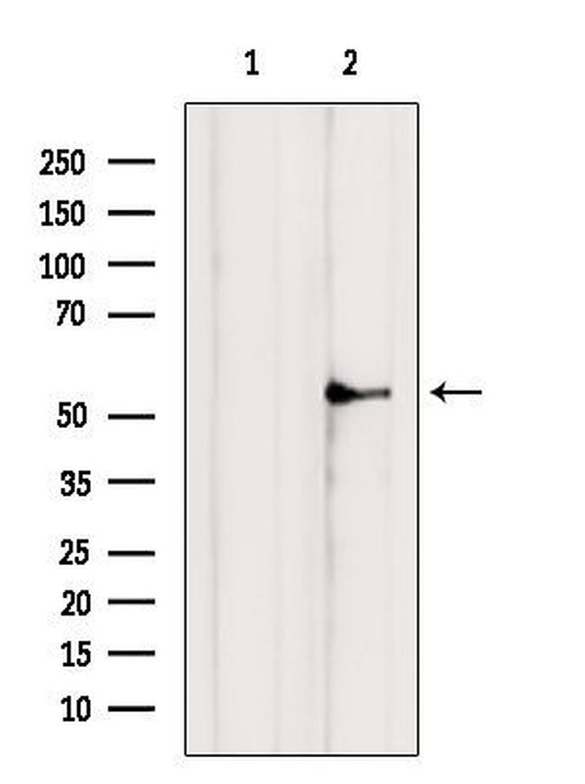 NRF1 Antibody in Western Blot (WB)