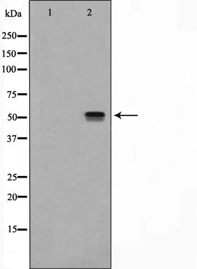 NRF1 Antibody in Western Blot (WB)