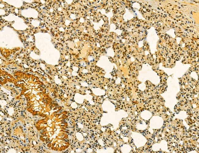 MKL1 Antibody in Immunohistochemistry (Paraffin) (IHC (P))