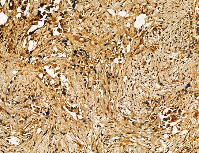 MKL1 Antibody in Immunohistochemistry (Paraffin) (IHC (P))