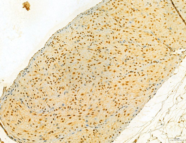 MKL1 Antibody in Immunohistochemistry (Paraffin) (IHC (P))