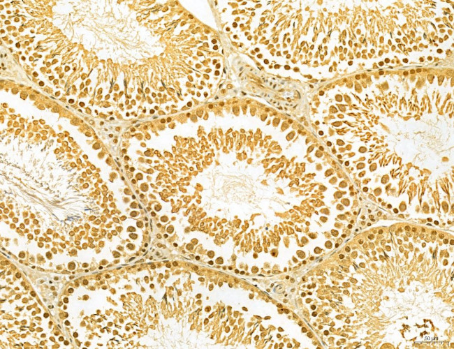 MKL1 Antibody in Immunohistochemistry (Paraffin) (IHC (P))