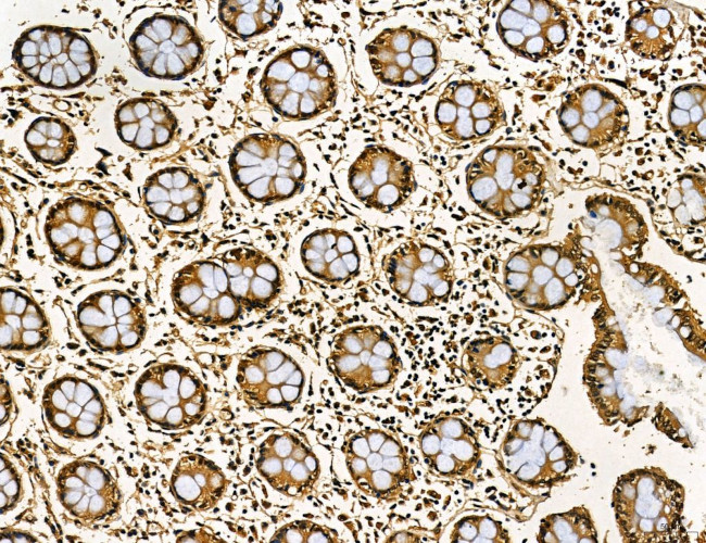 MKL1 Antibody in Immunohistochemistry (Paraffin) (IHC (P))