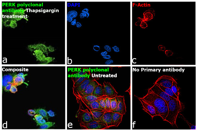 PERK Antibody in Immunocytochemistry (ICC/IF)