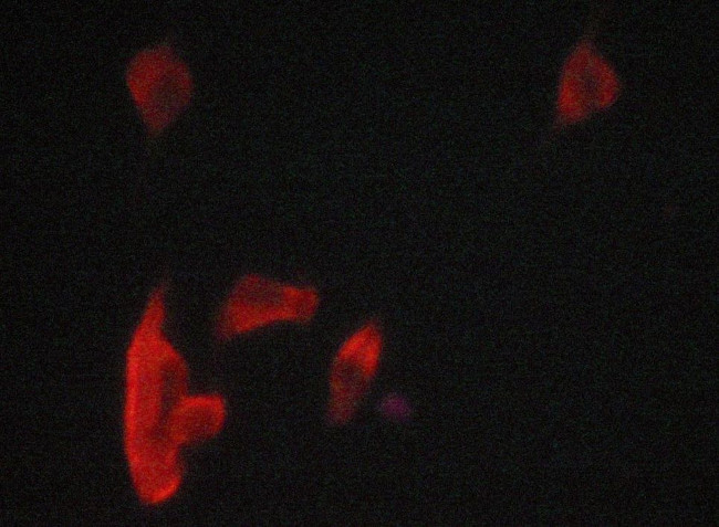 PERK Antibody in Immunocytochemistry (ICC/IF)