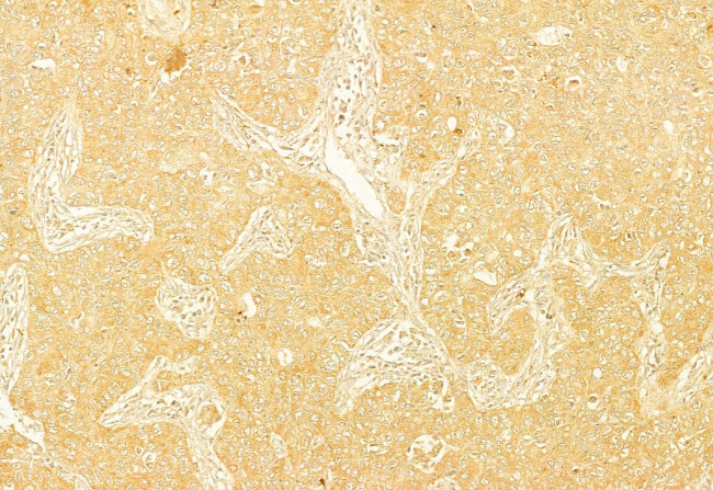 PERK Antibody in Immunohistochemistry (Paraffin) (IHC (P))