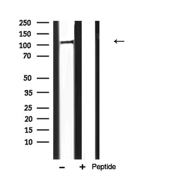 PERK Antibody in Western Blot (WB)