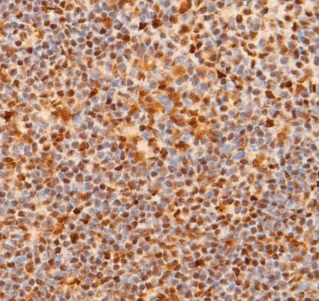 NOTCH1 (Cleaved Val1744) Antibody in Immunohistochemistry (Paraffin) (IHC (P))