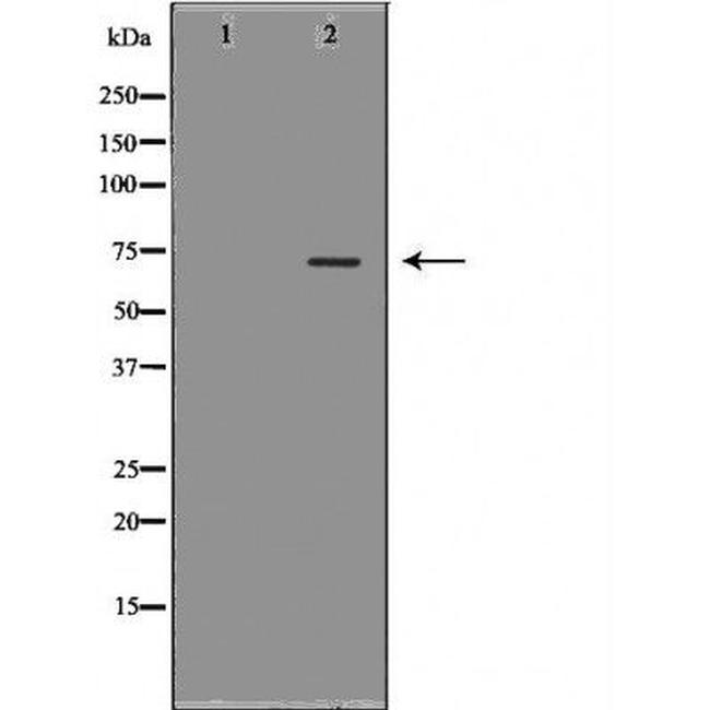 MTA1 Antibody in Western Blot (WB)