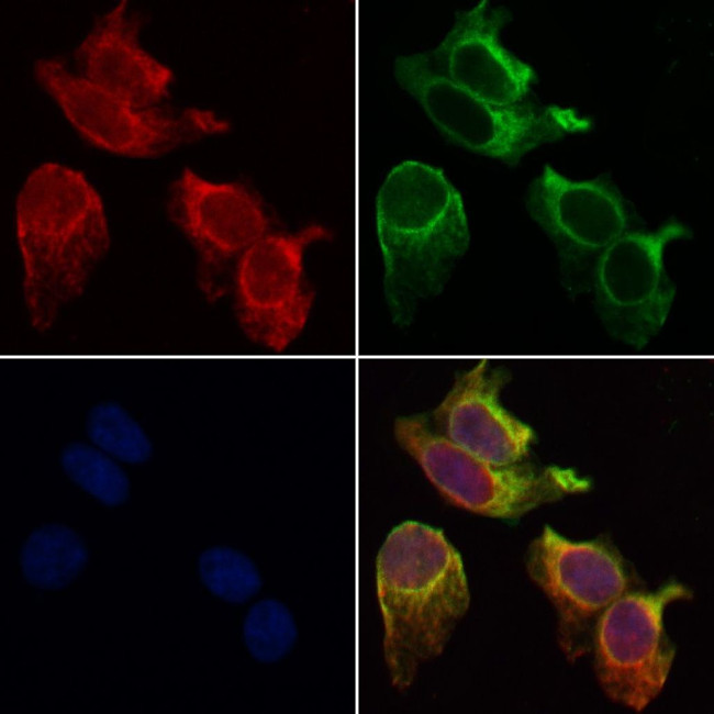 beta Synuclein Antibody in Immunocytochemistry (ICC/IF)