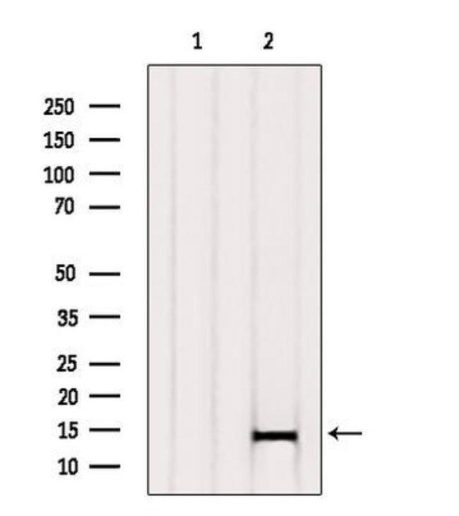 beta Synuclein Antibody in Western Blot (WB)