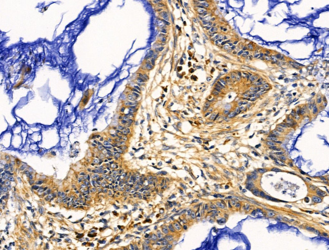 ACTA1 Antibody in Immunohistochemistry (Paraffin) (IHC (P))